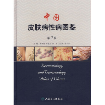 中國皮膚病性病圖鑒（第2版） pdf epub mobi 下载