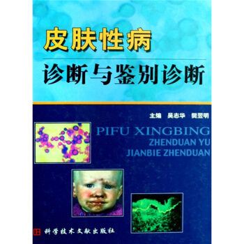 皮膚性病診斷與鑒彆診斷 pdf epub mobi 下载