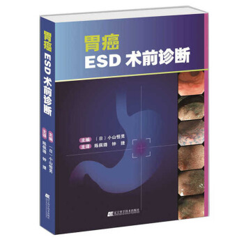 胃癌ESD術前診斷 包郵
