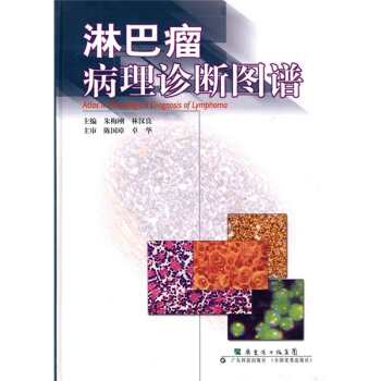 淋巴瘤病理診斷圖譜 pdf epub mobi 下载