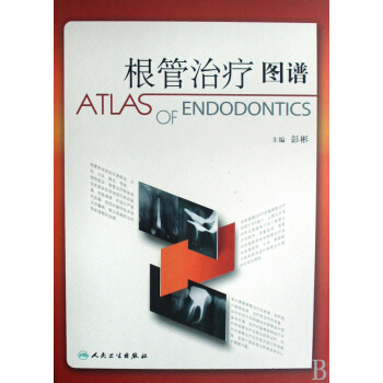 根管治疗图谱(精) pdf epub mobi 下载