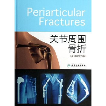 关节周围骨折 pdf epub mobi 下载