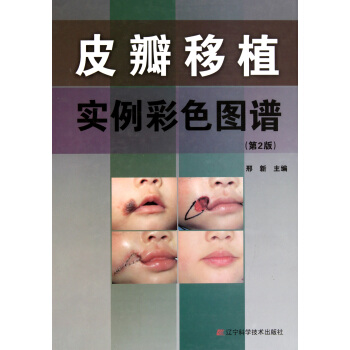皮瓣移植实例彩色图谱(第2版)(精) pdf epub mobi 下载
