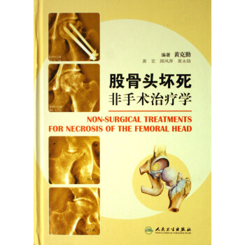 股骨头坏死非手术治疗学(精)
