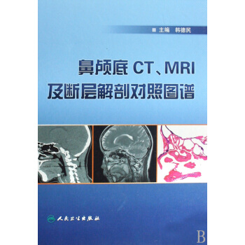 鼻颅底CTMRI及断层解剖对照图谱(精) pdf epub mobi 电子书 下载