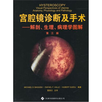宮腔鏡診斷及手術：解剖、生理、病理學圖解 [Hysteroscopy:Visual Perspectives of Uterine Anatomy,Physiology and Pathology] pdf epub mobi 下载