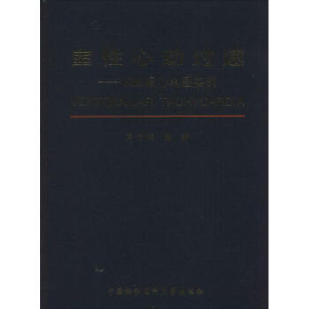 室性心动过速