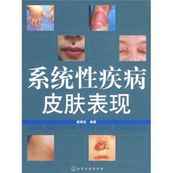 系统性疾病皮肤表现 pdf epub mobi 下载