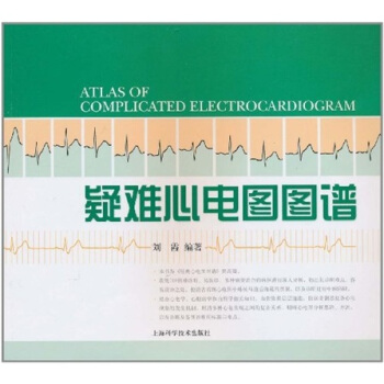 疑难心电图图谱 pdf epub mobi 下载