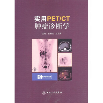 实用PET/CT肿瘤诊断学 pdf epub mobi 电子书 下载