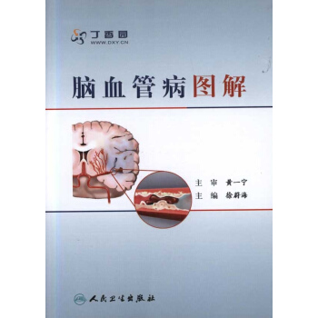 腦血管病圖解