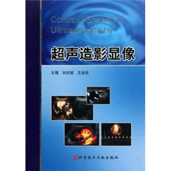 超聲造影顯像 pdf epub mobi 下载