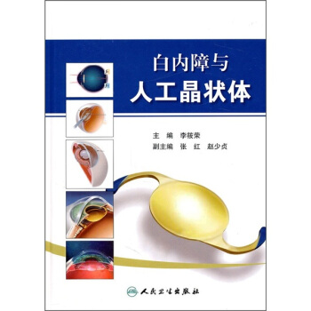 白內障與人工晶狀體 pdf epub mobi 下载