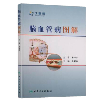 腦血管病圖解 pdf epub mobi 下载