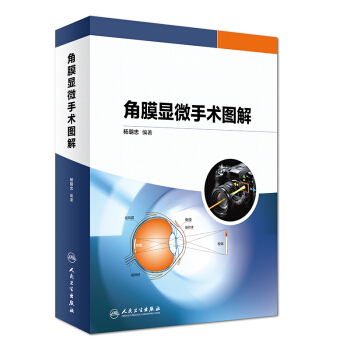 正版現貨 角膜顯微手術圖解 楊朝忠編著 人民衛生齣版社 pdf epub mobi 電子書 下載