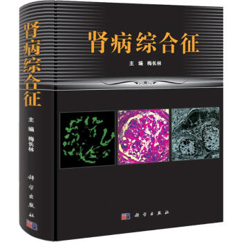 肾病综合征 pdf epub mobi 下载