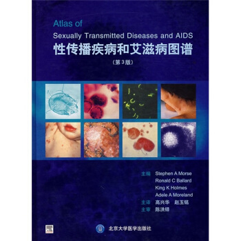性傳播疾病和艾滋病圖譜（第3版） [Sexually Transmitted Diseases and AIDS] pdf epub mobi 下载
