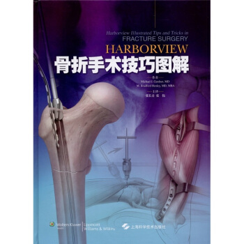 Harborview 骨摺手術技巧圖解 pdf epub mobi 下载