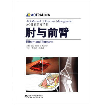AO骨摺治療手冊：肘與前臂 [AO Manual of Fracture Management] pdf epub mobi 下载