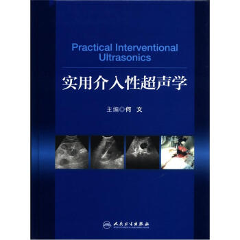 实用介入性超声学 [Practical Interventional Ultrasonics] pdf epub mobi 下载