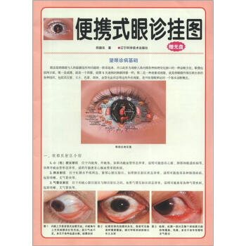 便携式眼诊挂图（附光盘1张） pdf epub mobi 下载