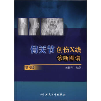 骨關節創傷X綫診斷圖譜（第3版） pdf epub mobi 下载