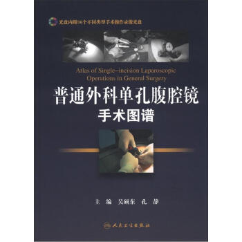普通外科单孔腹腔镜手术图谱（附光盘2张） [Atlas of Single-incision Laparoscopic Operations in General Surgery] pdf epub mobi 下载