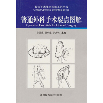 普通外科手術要點圖解