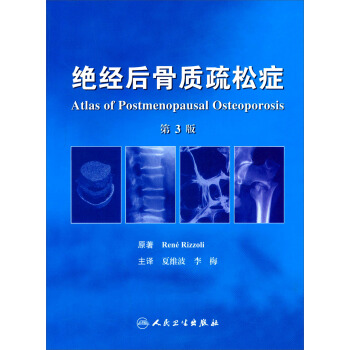 绝经后骨质疏松症（第3版） [Atlas of Postmenopausal Osteoporosis] pdf epub mobi 下载