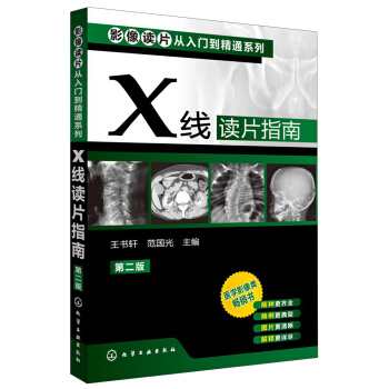 影像讀片從入門到精通係列：X綫讀片指南（第2版） pdf epub mobi 下载