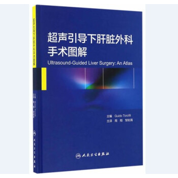 超聲引導下肝髒外科手術圖解(翻譯版) pdf epub mobi 下载