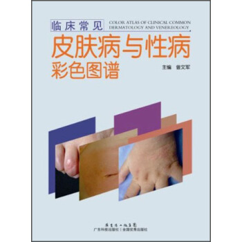 临床常见皮肤病与性病彩色图谱 pdf epub mobi 下载
