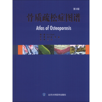 骨質疏鬆癥圖譜（第3版） [Atlas of Osteoporosis] pdf epub mobi 下载