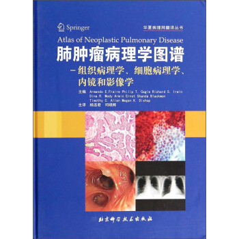 華夏病理網翻譯叢書·肺腫瘤病理診斷圖譜：組織病理學細胞病理學內鏡和影像學 [Atlas of Neoplastic Pulmonary Disease，Pathology，Cytology，Endoscopy and Radiology] pdf epub mobi 下载