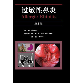 过敏性鼻炎（第2版） [Allergic Rhinitis] pdf epub mobi 电子书 下载