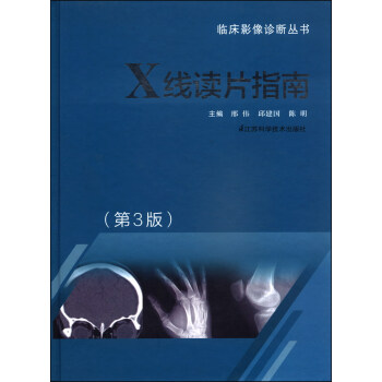 临床影像诊断丛书：X线读片指南（第3版） pdf epub mobi 下载