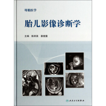 母胎醫學·胎兒影像診斷學 pdf epub mobi 下载