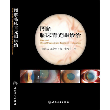 图解临床青光眼诊治 pdf epub mobi 下载