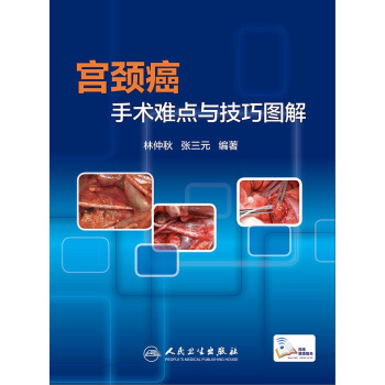 宫颈癌手术难点与技巧图解