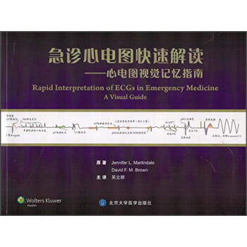 急診心電圖快速解讀:心電圖視覺記憶指南(W)
