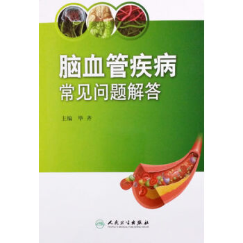 腦血管疾病常見問題解答 pdf epub mobi 電子書 下載