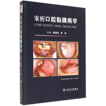 案析口腔黏膜病学 pdf epub mobi 下载