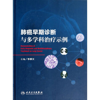 肺癌早期诊断与多学科治疗示例 [Demonstration of Early Diagnosis and Multidisciplinary Treatment on Lung Cancer] pdf epub mobi 下载