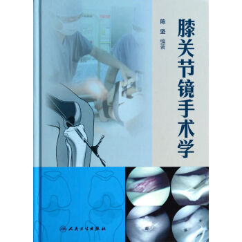 膝关节镜手术学 pdf epub mobi 下载