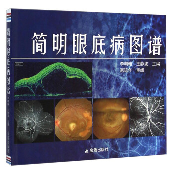 簡明眼底病圖譜 pdf epub mobi 下载