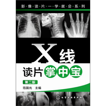 影像读片一学就会系列：X线读片掌中宝（第二版） pdf epub mobi 下载