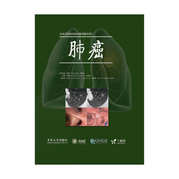 肺癌 pdf epub mobi 下载