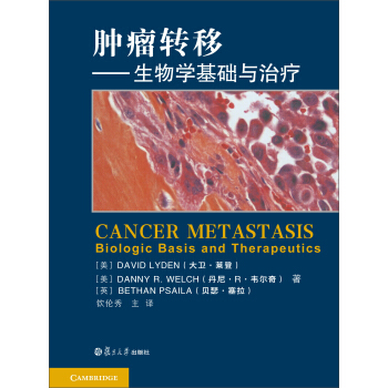 腫瘤轉移：生物學基礎及治療 [Cancer Metastasis Biologic Basis and Therapeutics] pdf epub mobi 下载