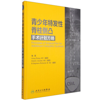 青少年特发性脊柱侧凸手术计划方略 [Principles of Surgical Plan for Adolescent Idiopathic Scoliosis] pdf epub mobi 电子书 下载