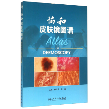 協和皮膚鏡圖譜 [Atlas Of Dermoscopy] pdf epub mobi 下载